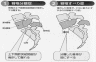 説明: 脊椎分離症・脊椎すべり症